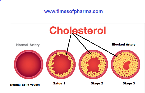 Cholesterol level limit